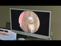 อุปกรณ์การผ่าตัด เครื่องผลิตพลาสมาความถี่รังสีความถี่สูง